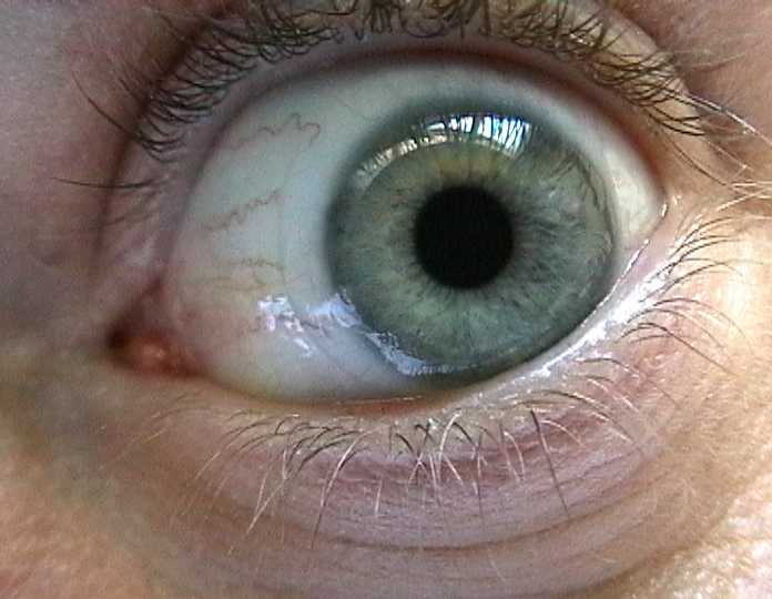 jakeuglyeye