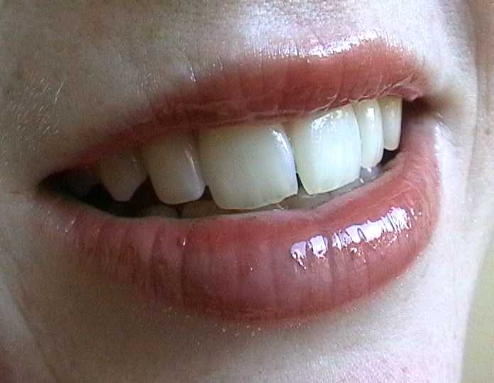 lips